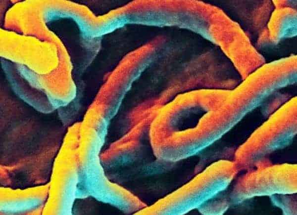There’s an Ebola Vaccine in Africa. Now What?