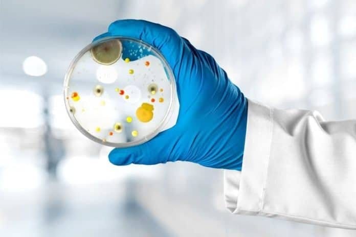 bacteria growth