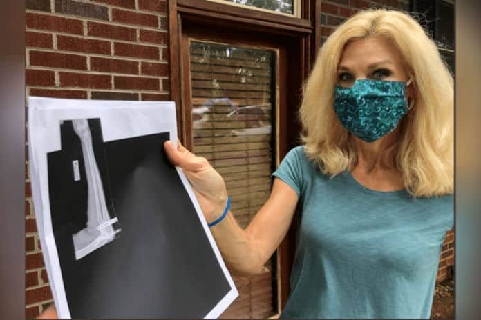 Peggy Fox holding X-ray