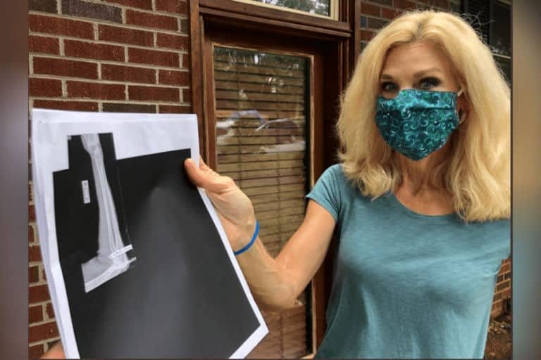 Peggy Fox holding X-ray