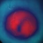Photo depicting ozone hole