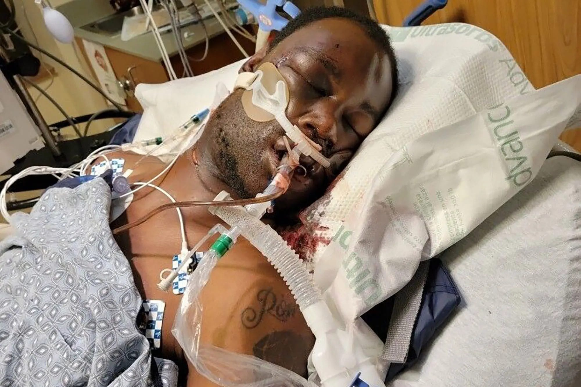 Tyre Nichols on his hospital bed